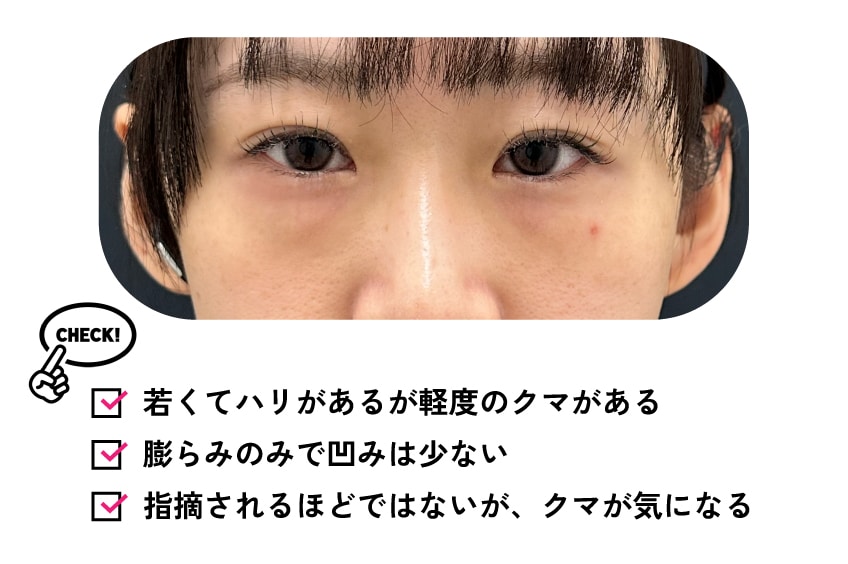 こんな人は脱脂術がおすすめ