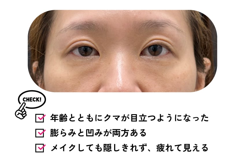 こんな人は裏ハムラ法がおすすめ