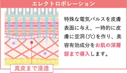 エレクトロポレーション（イオン導入）