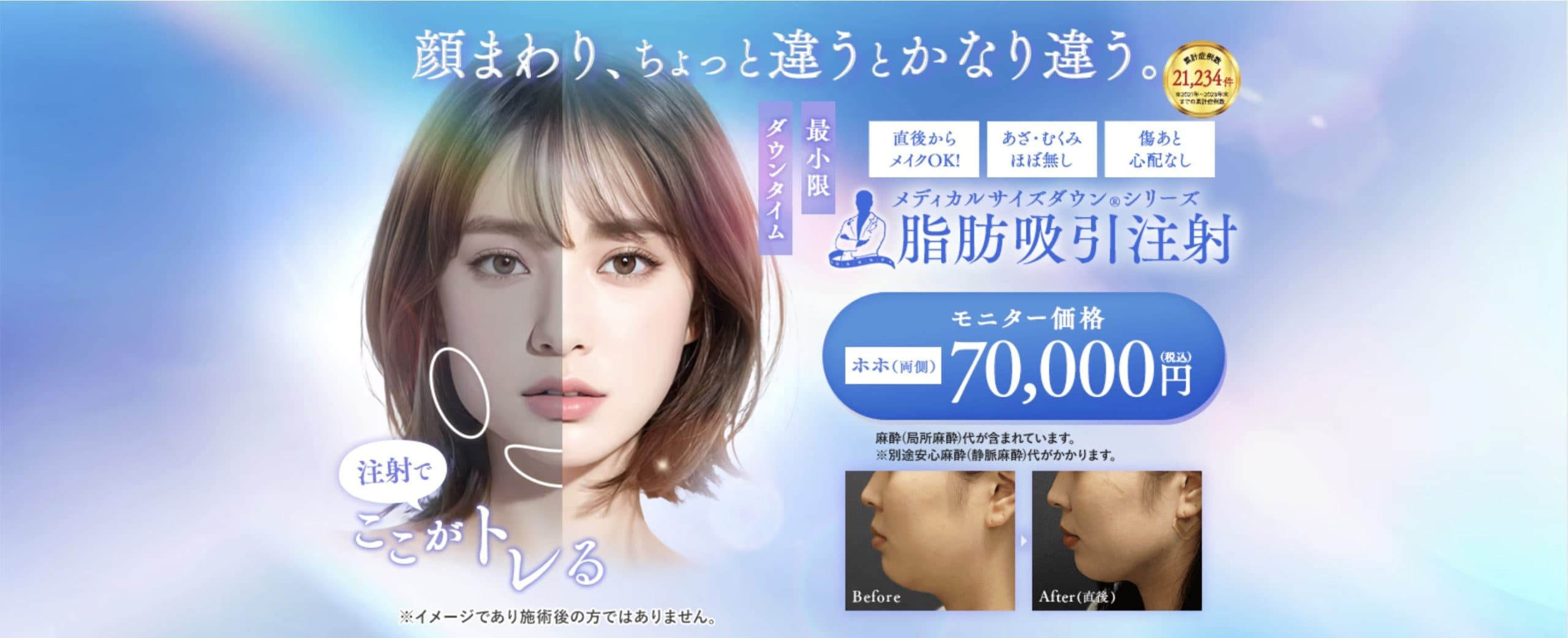 サポーター不要でダウンタイムも最小限！