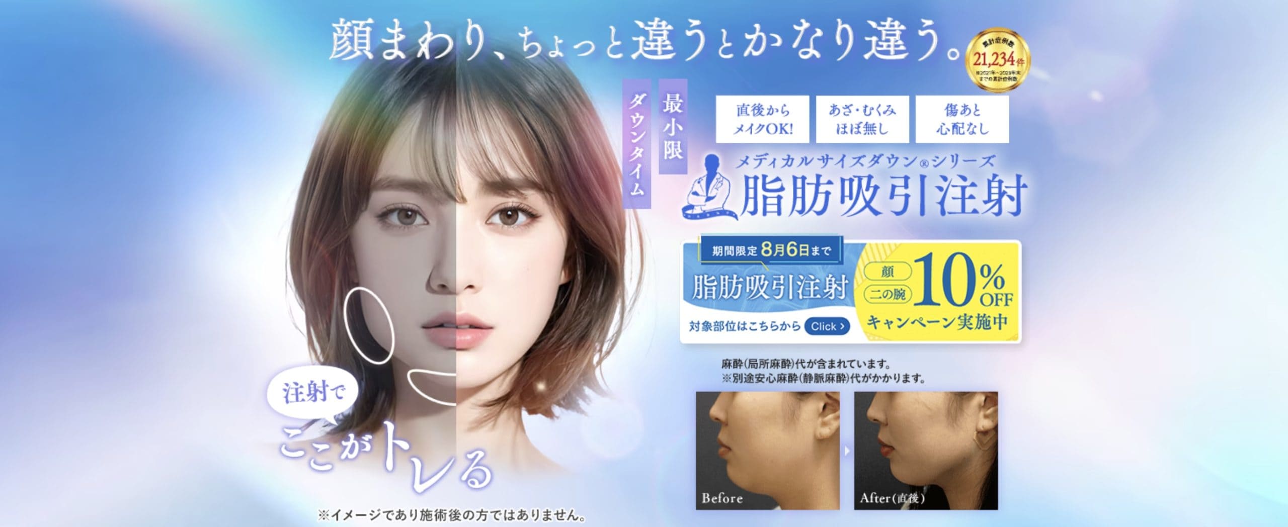 サポーター不要でダウンタイムも最小限！