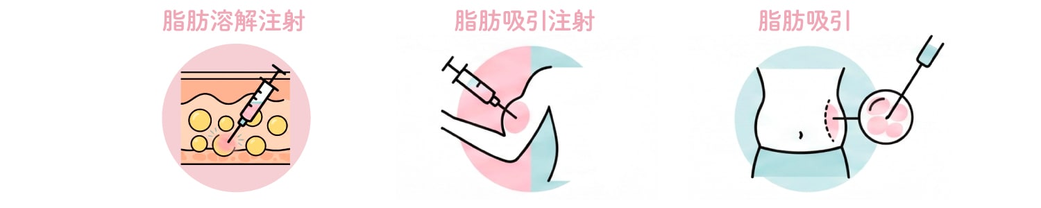 「脂肪吸引」と「脂肪溶解注射」のいいとこどり♩