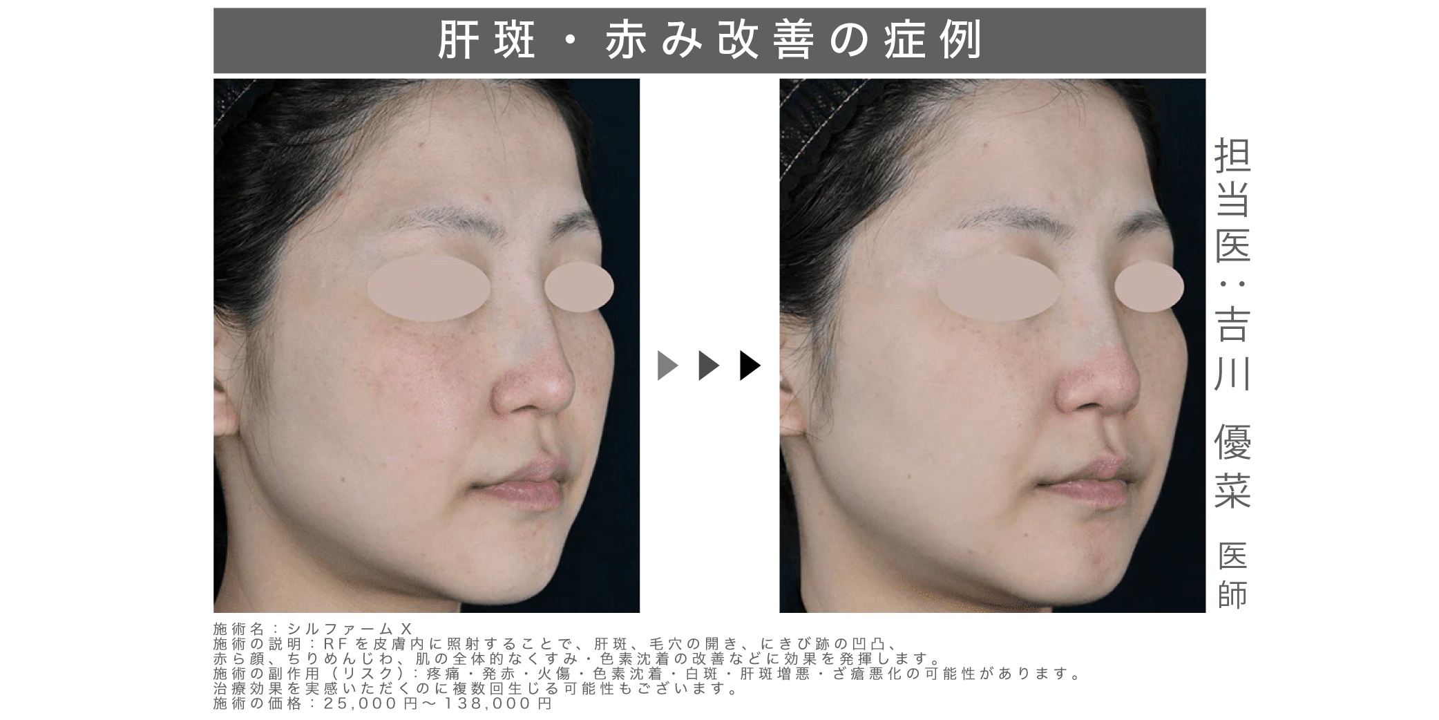 シルファームXで期待できる効果