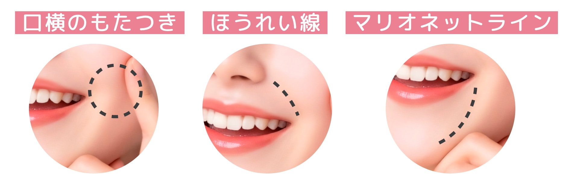 「ぽにょぴたスレッド」が新導入されました！