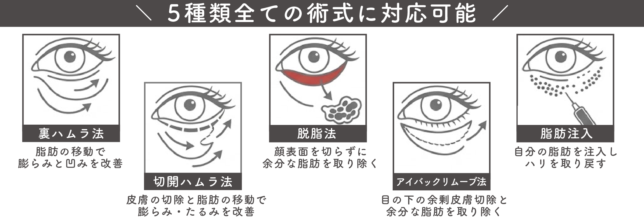 「あなたに合う」オーダーメイドなクマとりを。