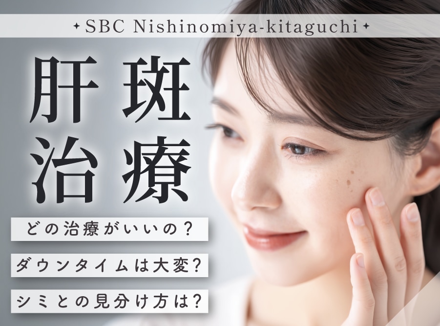 【神戸・西宮】肝斑治療ならSBC西宮北口院|見分け方とダウンタイム・おすすめ施術