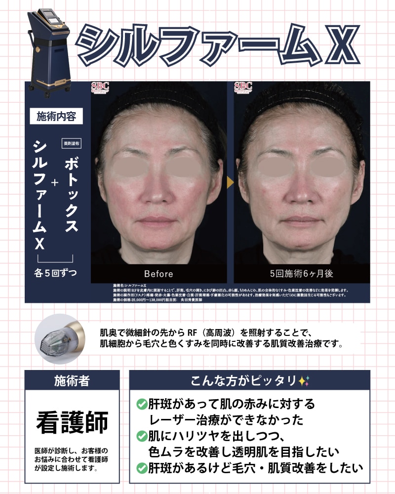 シルファーム症例