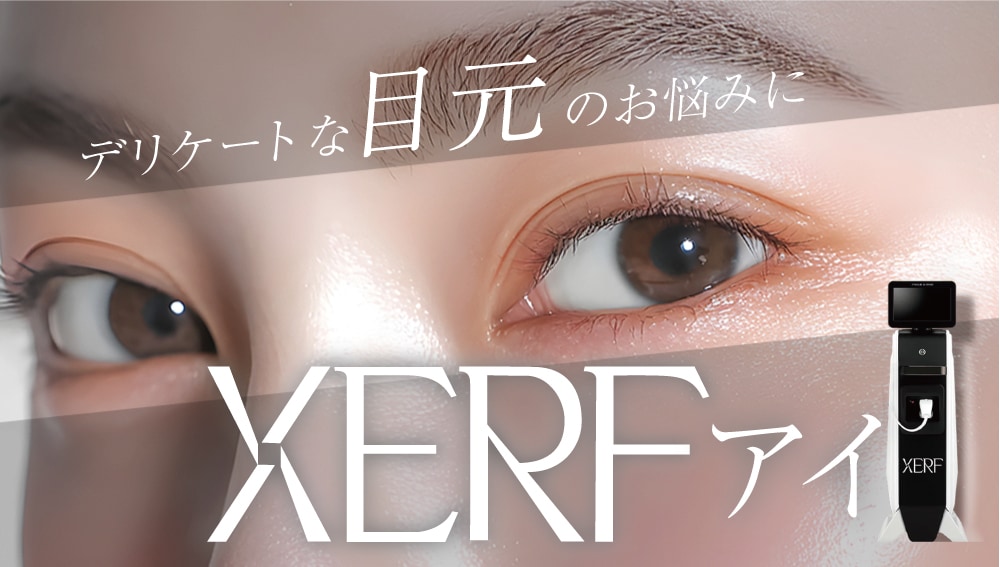 XERFアイ