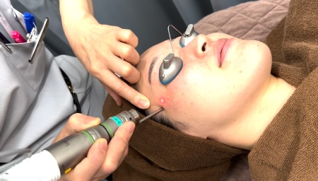 照射開始