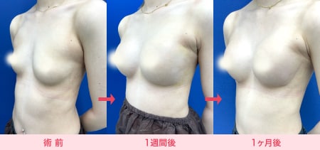 立っても寝ても自然な形状をキープできる「Motiva エルゴノミックス2」