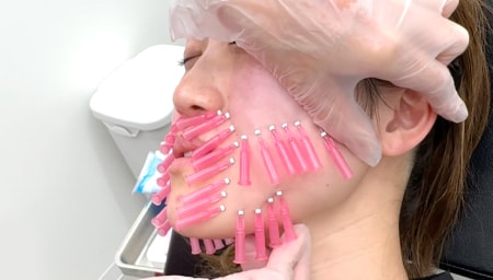 何本くらい糸を入れるのが一般的ですか?