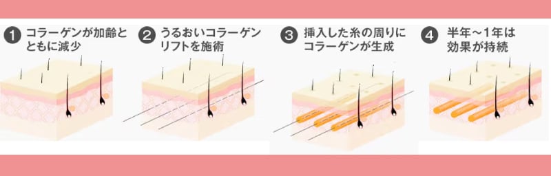 効果はどのくらい持続しますか？