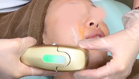 定期的な施術