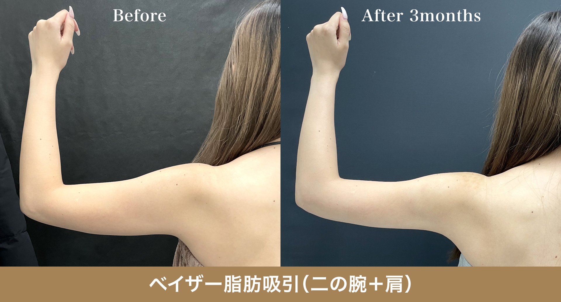 二の腕：ムキッとならない「女性らしいライン」