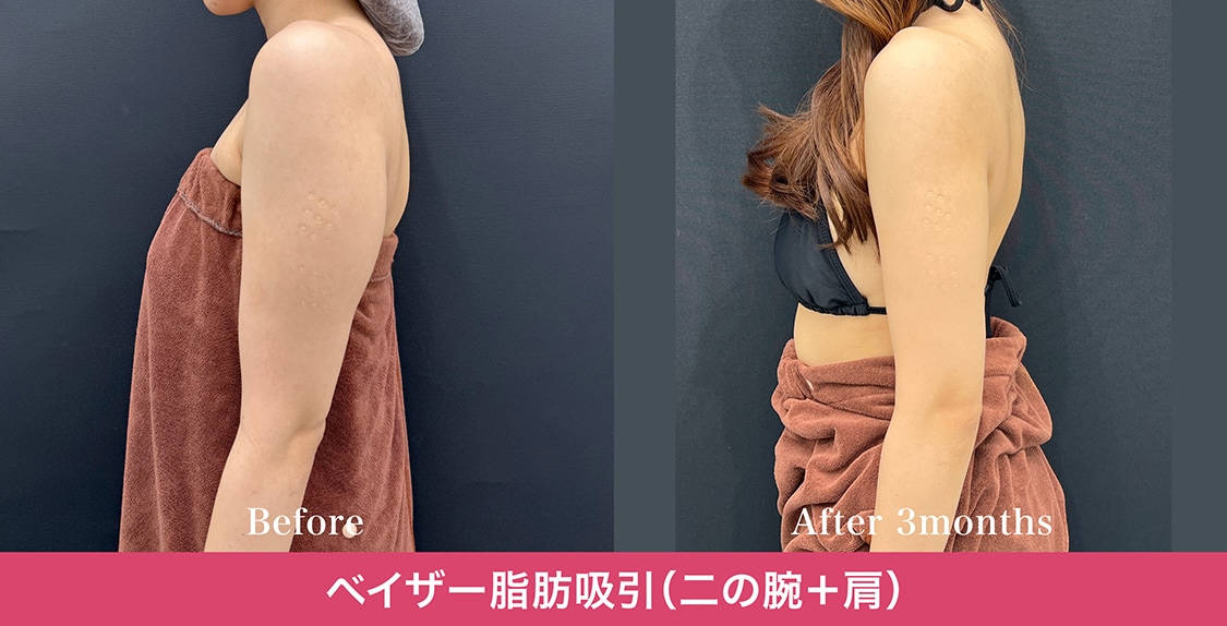 「ただ細い」だけじゃない！女性らしいグラデーション