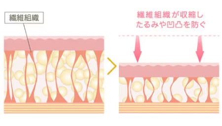 皮膚の引き締め効果