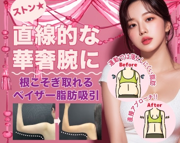 【2026年二の腕痩せ】夏に堂々とノースリーブを着るなら「1月」が正解！傷跡・凸凹なしを目指す谷口院長の「ベイザー脂肪吸引」