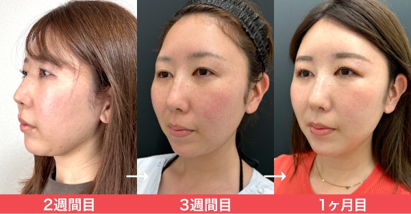モニター様のリアルな声
