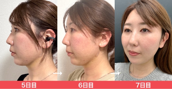 モニター様のリアルな声