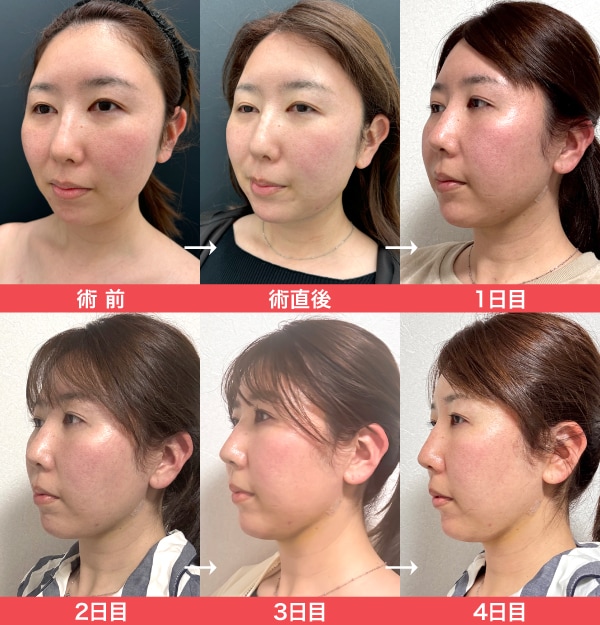 モニター様のリアルな声と過ごし方の工夫