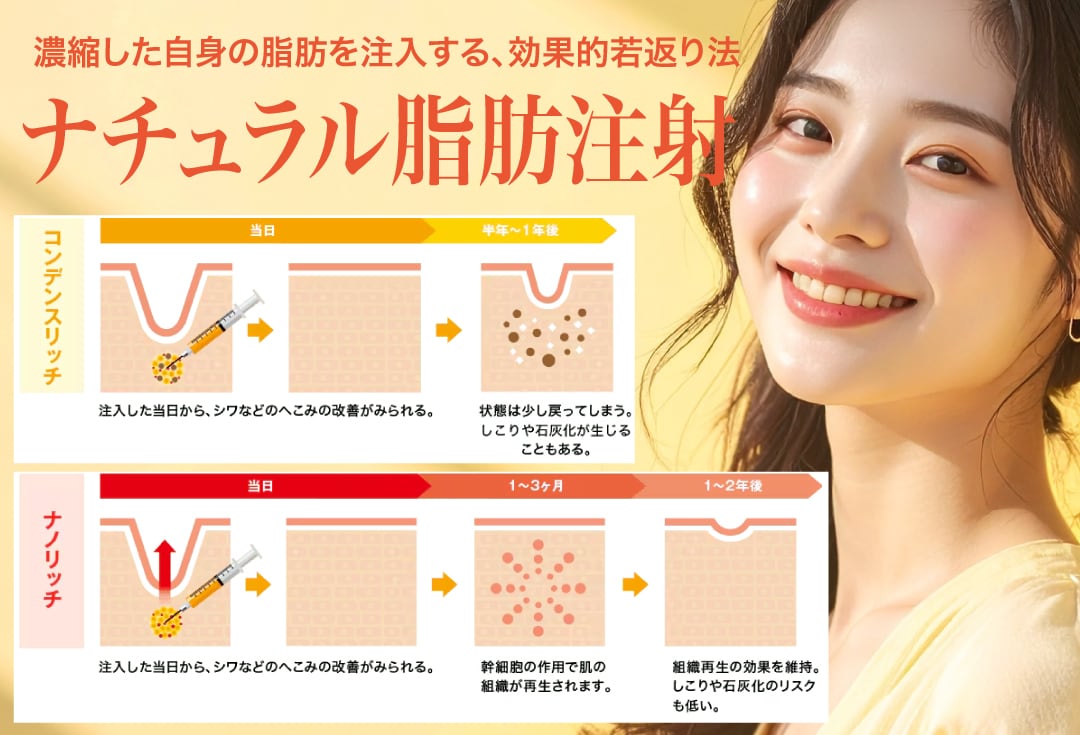  脂肪注入で「OGカーブ」を形成し、間延びを短縮