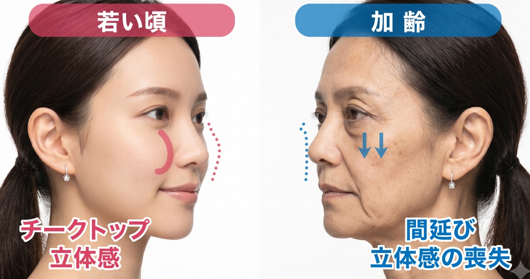 下瞼（しもまぶた）と中顔面（目の下から口元までのエリア）は密接な関係にある
