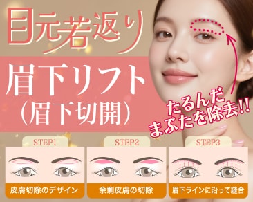 【小田原院】自然に若返る!眉下リフト(眉下切開)の魅力とは?谷口院長が選ばれる理由と効果を徹底紹介