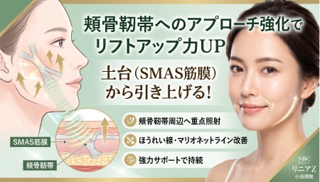 頬骨靭帯へのアプローチ強化でリフトアップ力UP