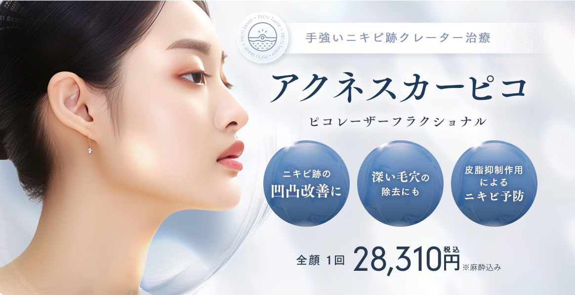 手強いニキビ跡には、【アクネスカーピコ】