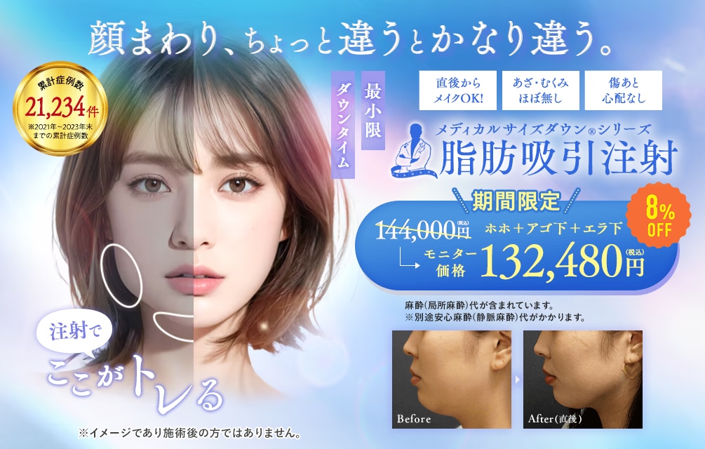 脂肪吸引注射（顔・ボディ）