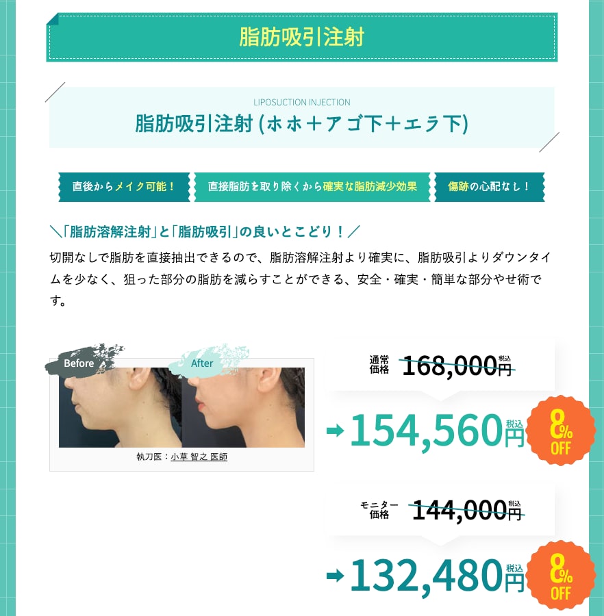 2025年8月6日までのキャンペーン（脂肪吸引注射）