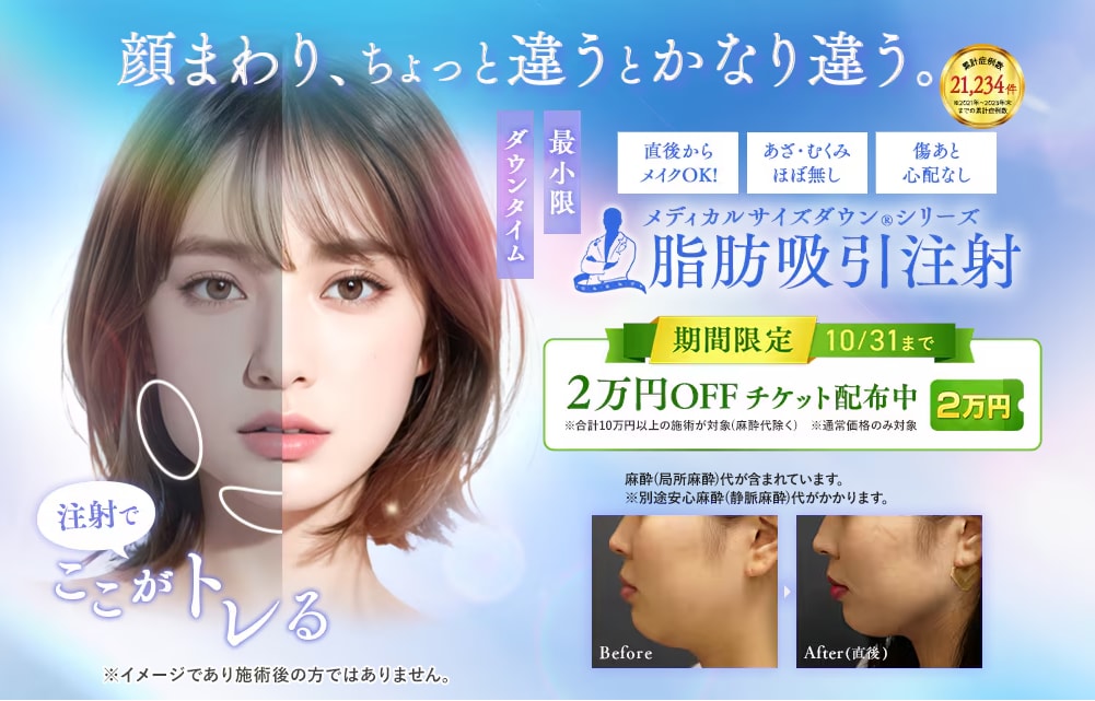 脂肪吸引注射（顔・ボディ）