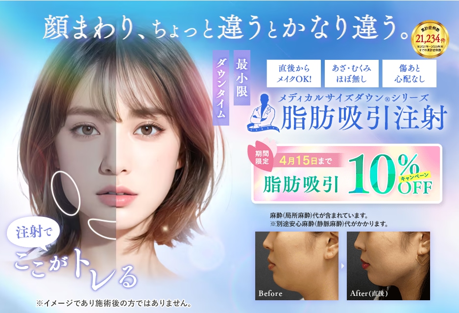 脂肪吸引注射（顔・ボディ）