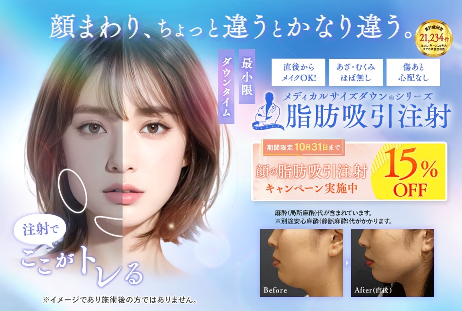 脂肪吸引注射（顔・ボディ）【脂肪除去率：約30〜50％】