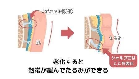 たるみ改善に特化したエイジング治療注射