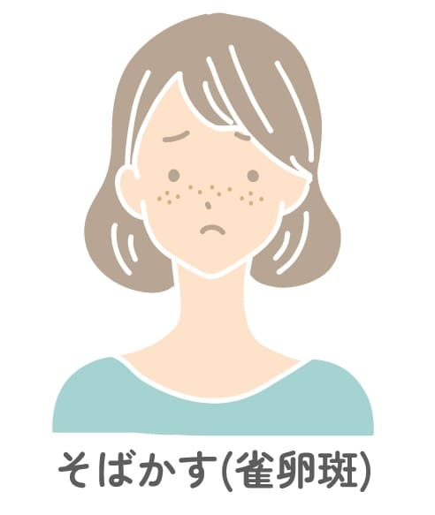 そばかす