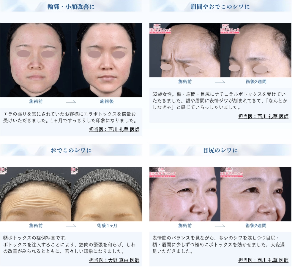 メンズ美容の人気治療TOP５【メンズ美容するなら湘南美容クリニック大分院】 - 大分院, image size:983x901