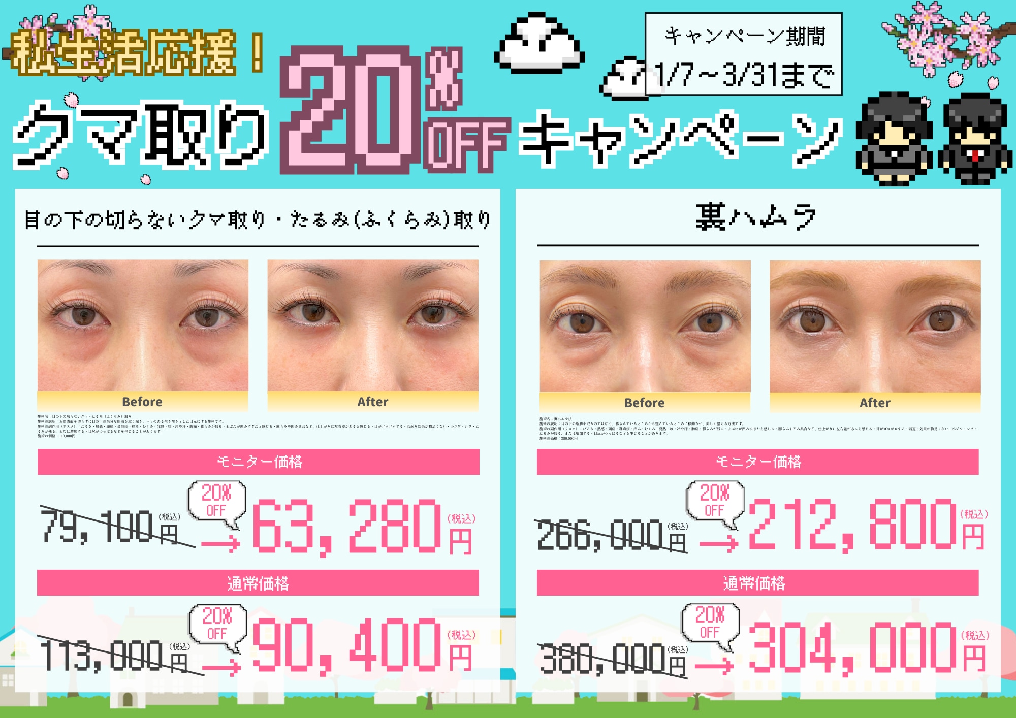 クマ取り20％OFFキャンペーン