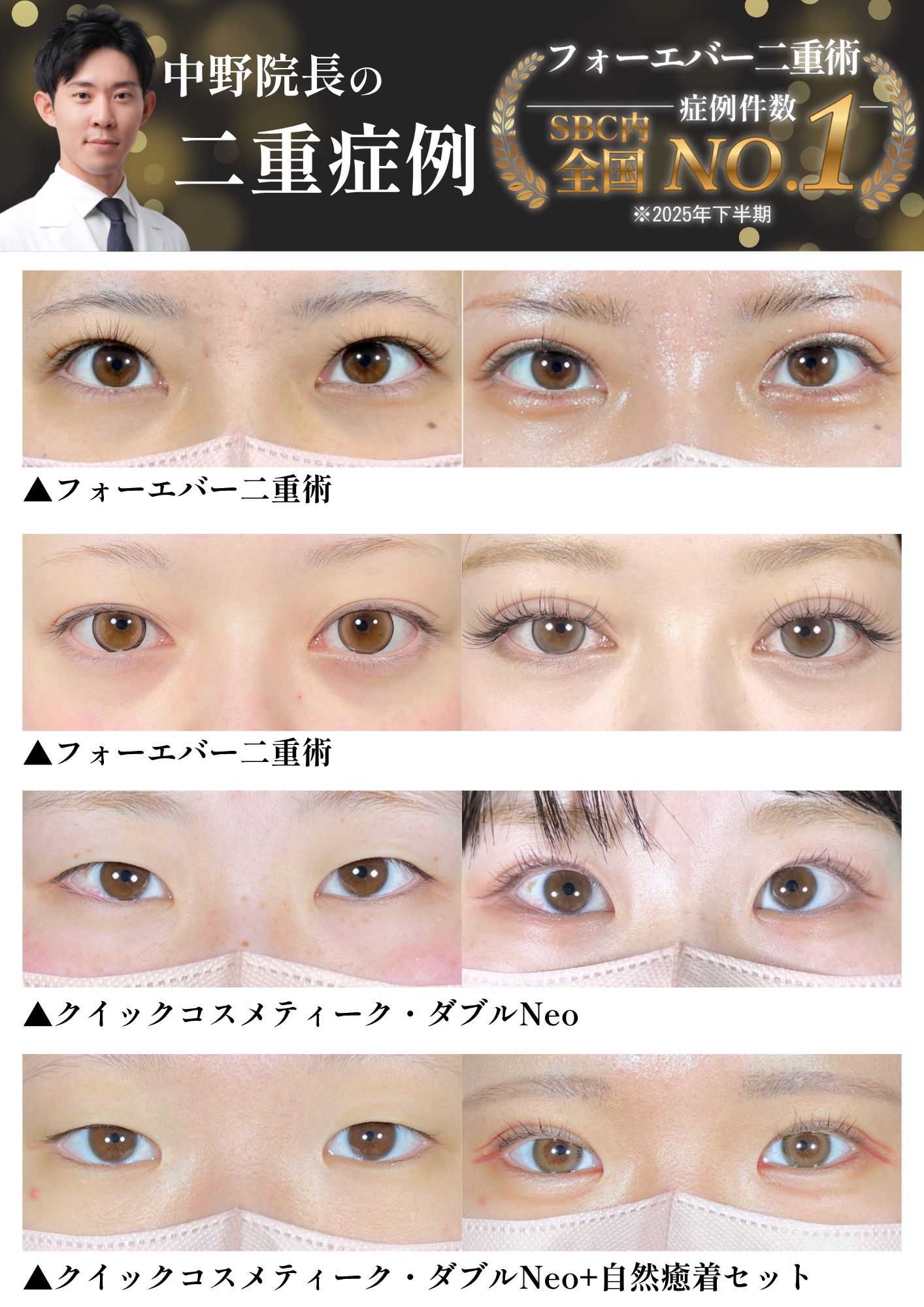 これが二重埋没、全国１位の実力