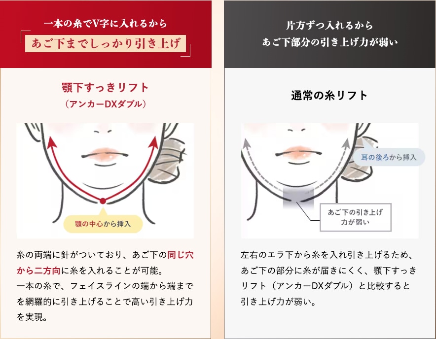 顎下すっきリフト