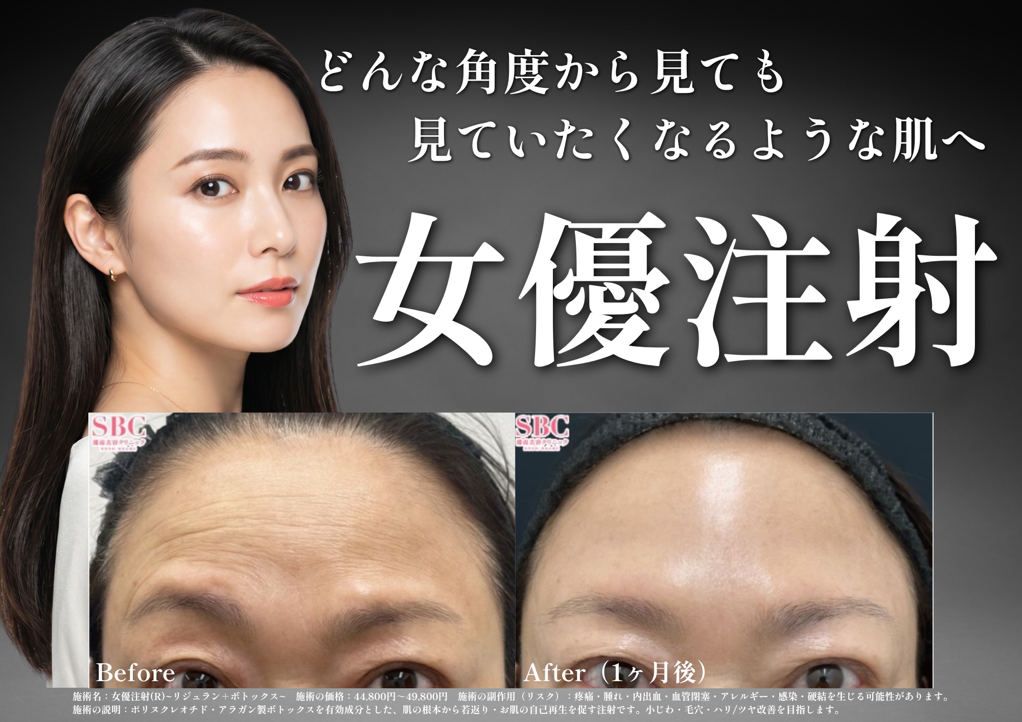 女優注射®︎