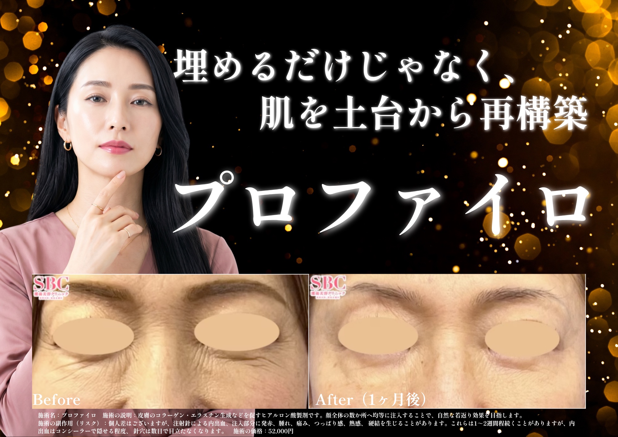 プロファイロ