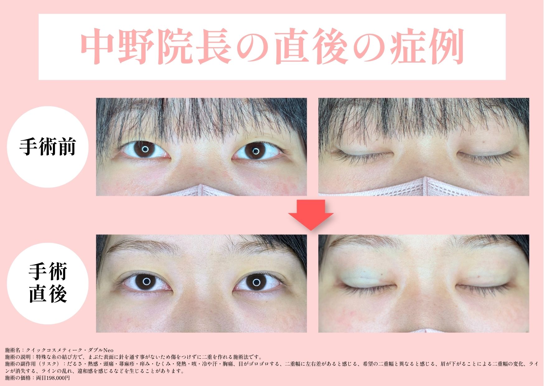 手術直後でも腫れにくい技術