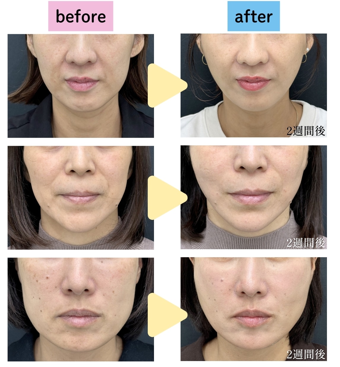 執刀医・塩入医師