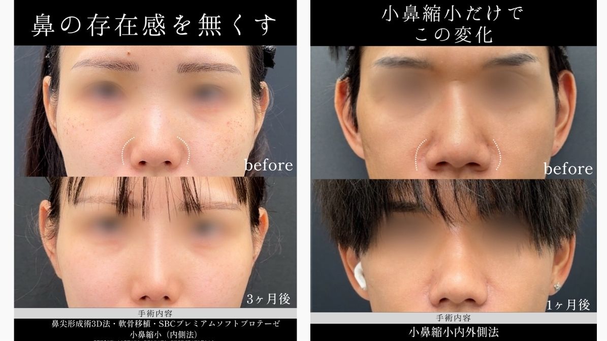 執刀医・平田院長