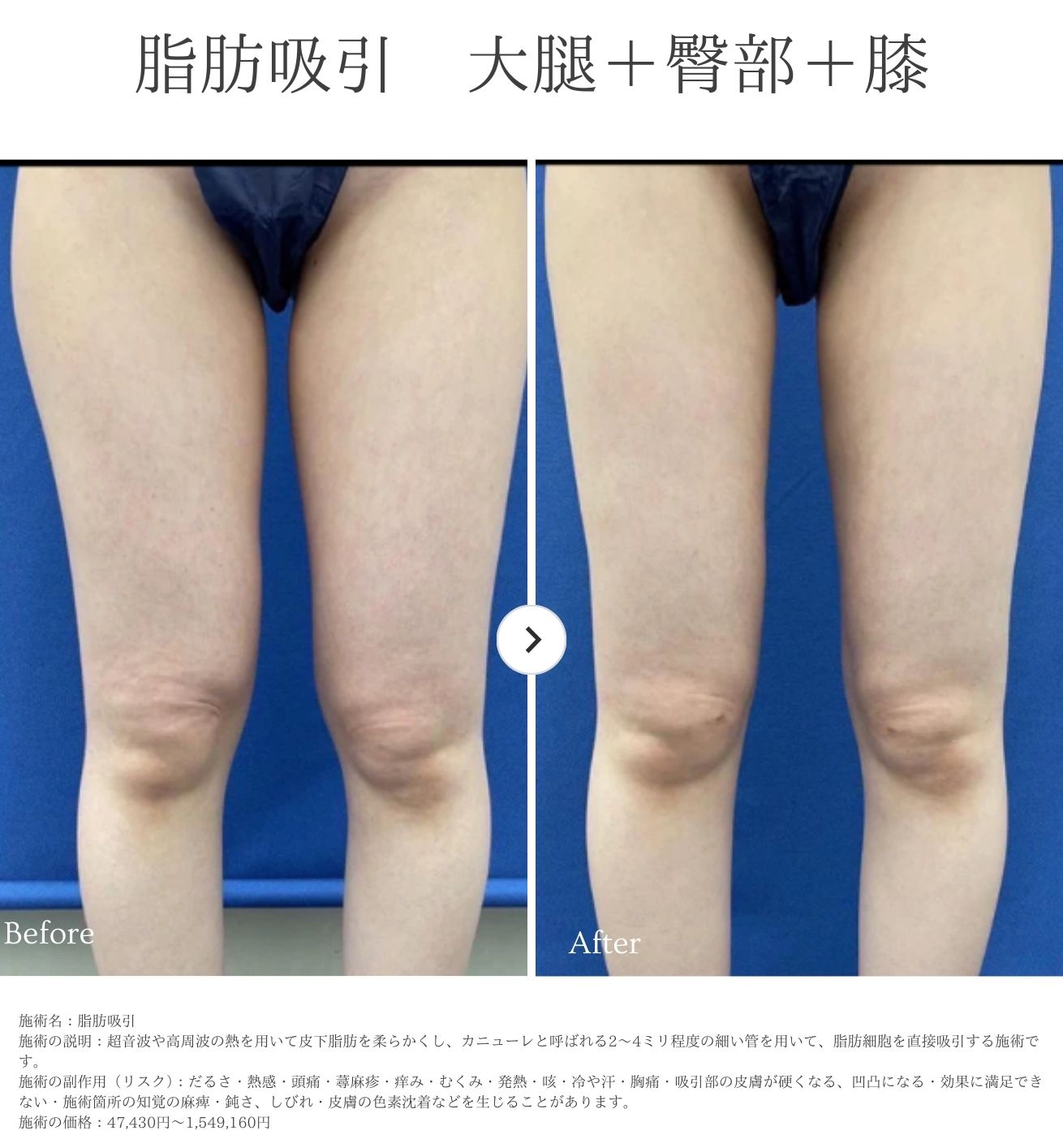 ■岡山院院長の平田医師による症例をご紹介します■