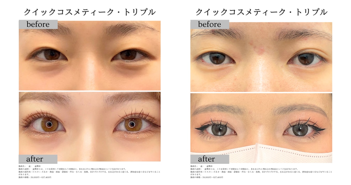 『どんな目元も可愛く＿綺麗に仕上げます』