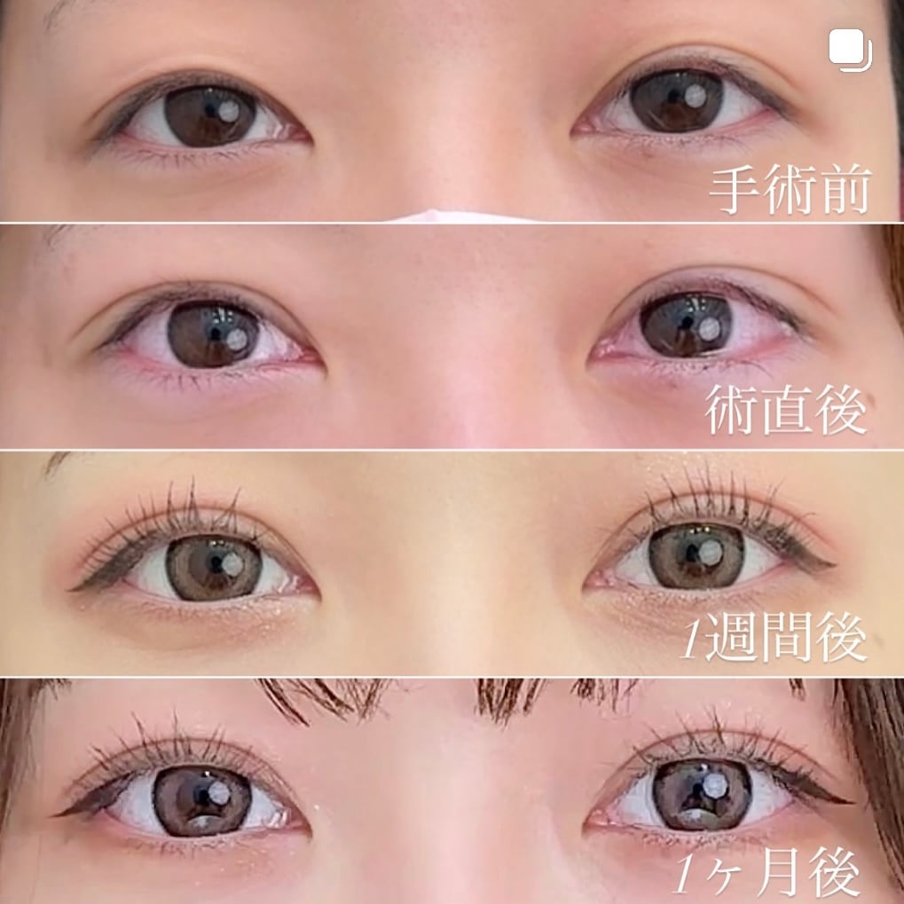 ◼️クイックコスメティーク・トリプル【平田　侑医師】◼️