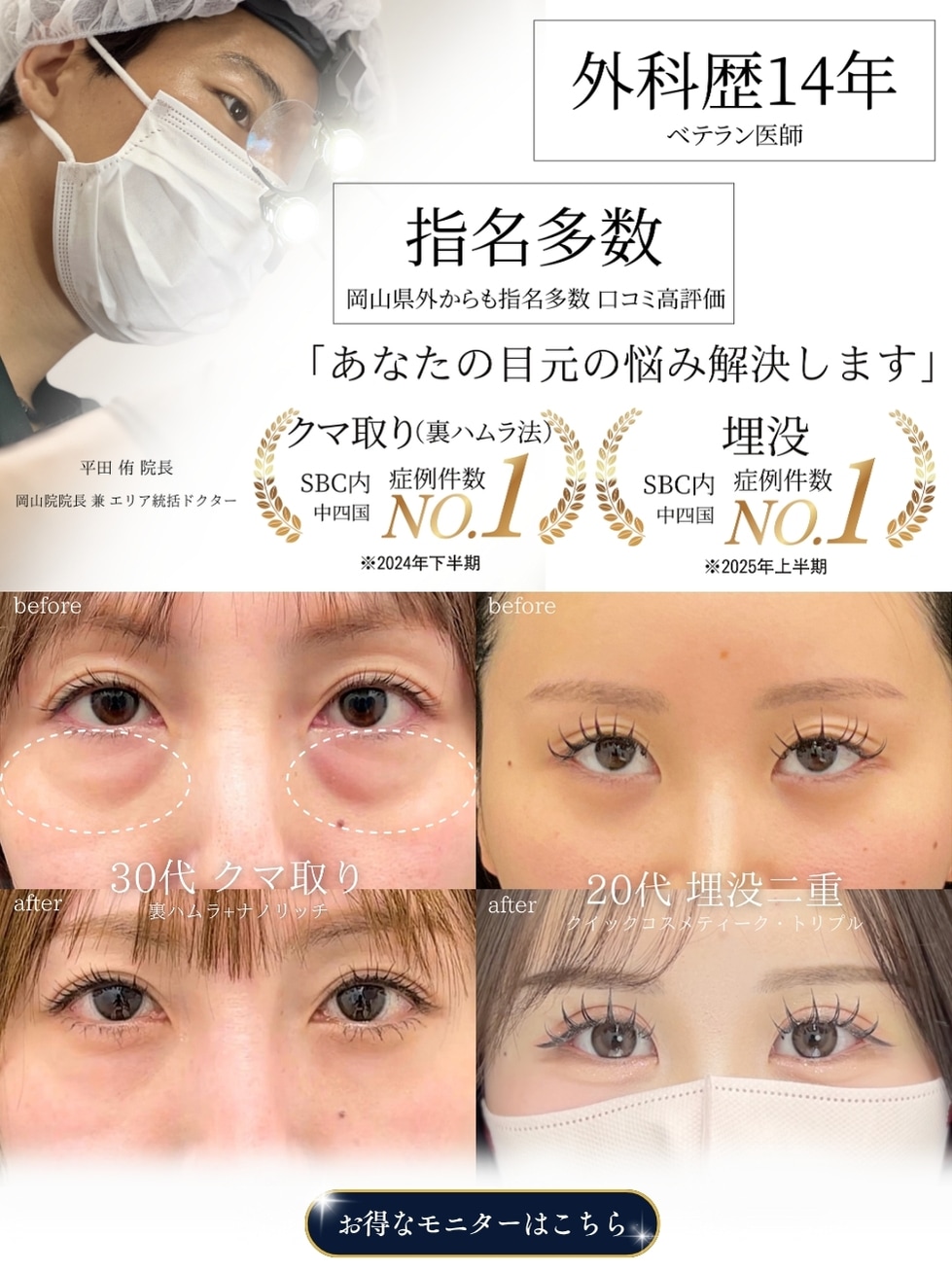 二重のモニターの応募はこちらから