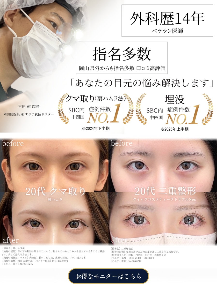 二重のモニターの応募はこちらから